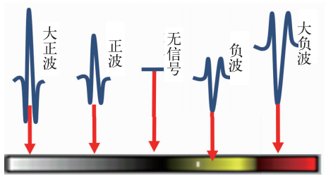DS9500声扫设备着色图